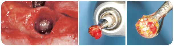 ethoss Degranulation Kit